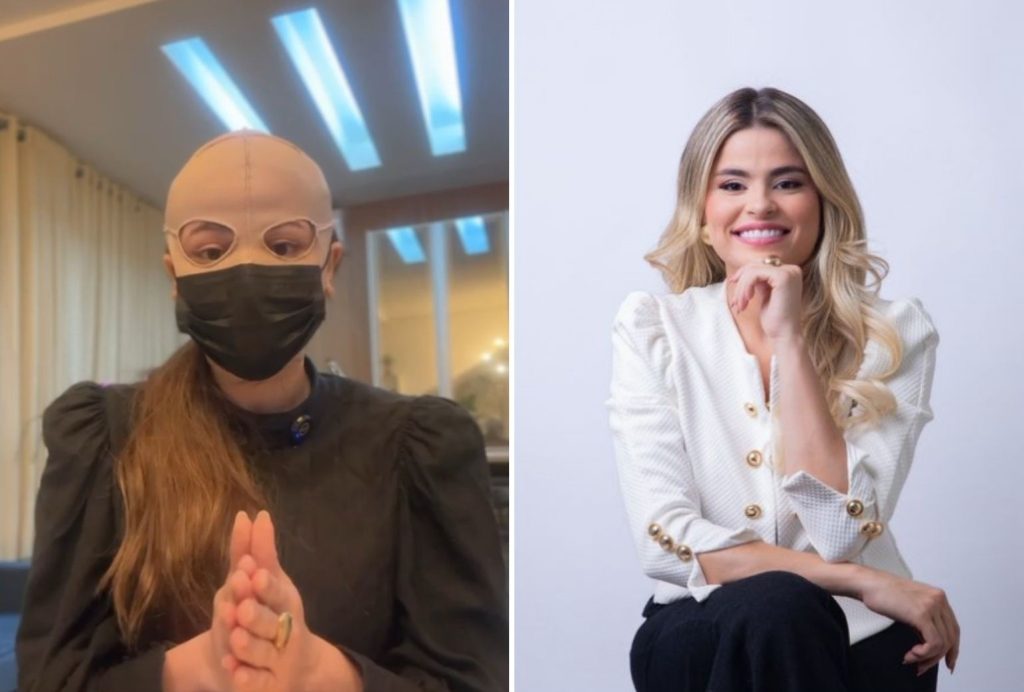 Dermatologistas explicam reações de peeling que causou queimaduras e fez médica usar máscara cobrindo todo rosto